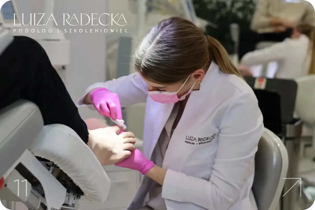 Klamra tytanowa w ortonyksji - szkolenie podologiczne